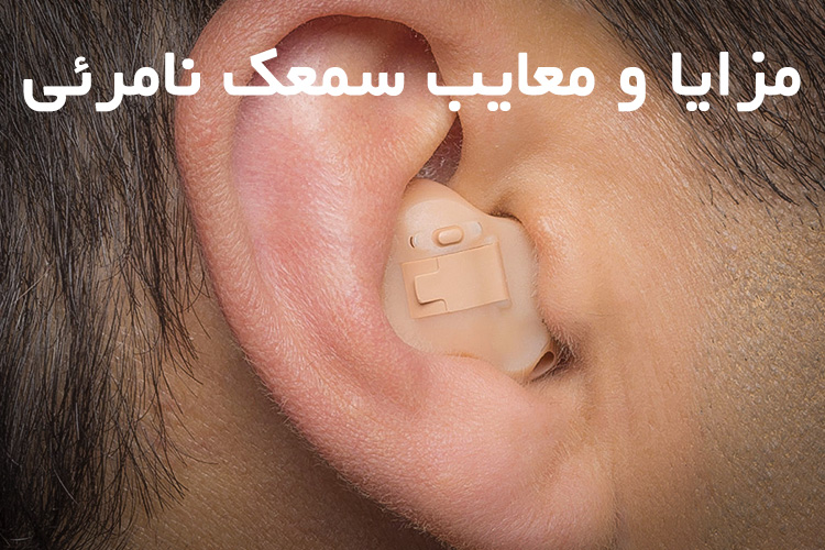 مزایا و معایب سمعک نامرئی مزایا و معایب سمعک نامرئی