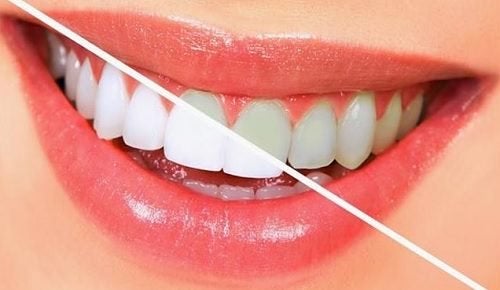 خوراکی ‌هایی که مثل مسواک دندان‌هایتان را تمیز می‌کنند +لیست مواد غذایی مفید برای سلامت دهان و دندان