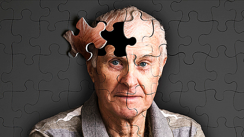 6 روش آسان اما موثر برای جلوگیری از آلزایمر زودرس در جوانی و سالمندی