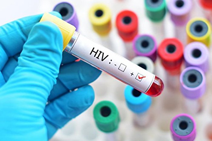 پنهانکاری در آمار HIV مازندران/ خفقان رسانهای در حوزه سلامت پنهانکاری در آمار HIV مازندران/ خفقان رسانهای در حوزه سلامت