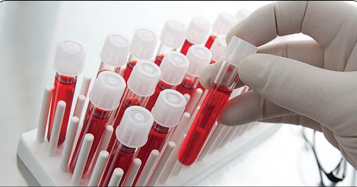 تاریخچه اختراع تزریق و ذخیره سازی خون تاریخچه اختراع تزریق و ذخیره سازی خون