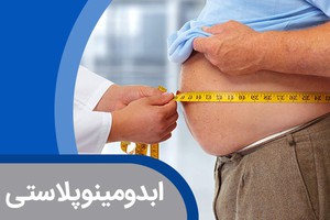 نگران اضافه وزن خود در عید نباشید! با ابدومینوپلاستی چاقی را شکست دهید