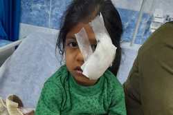 حمله سگ ولگرد به دختربچه در بهشهر