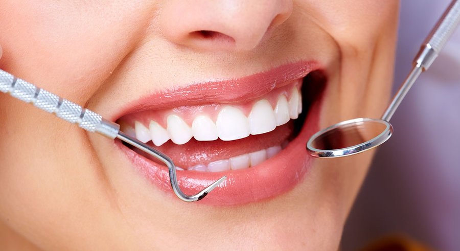 علت زرد شدن دندان‌ها چیست؟ | ۴ روش درمان زردی دندان در خانه