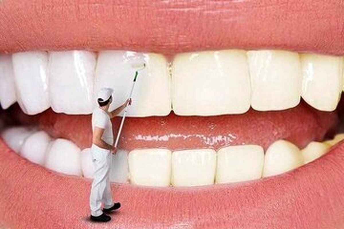 چگونه دندانها را به طور طبیعی سفید کنیم؟ چگونه دندانها را به طور طبیعی سفید کنیم؟